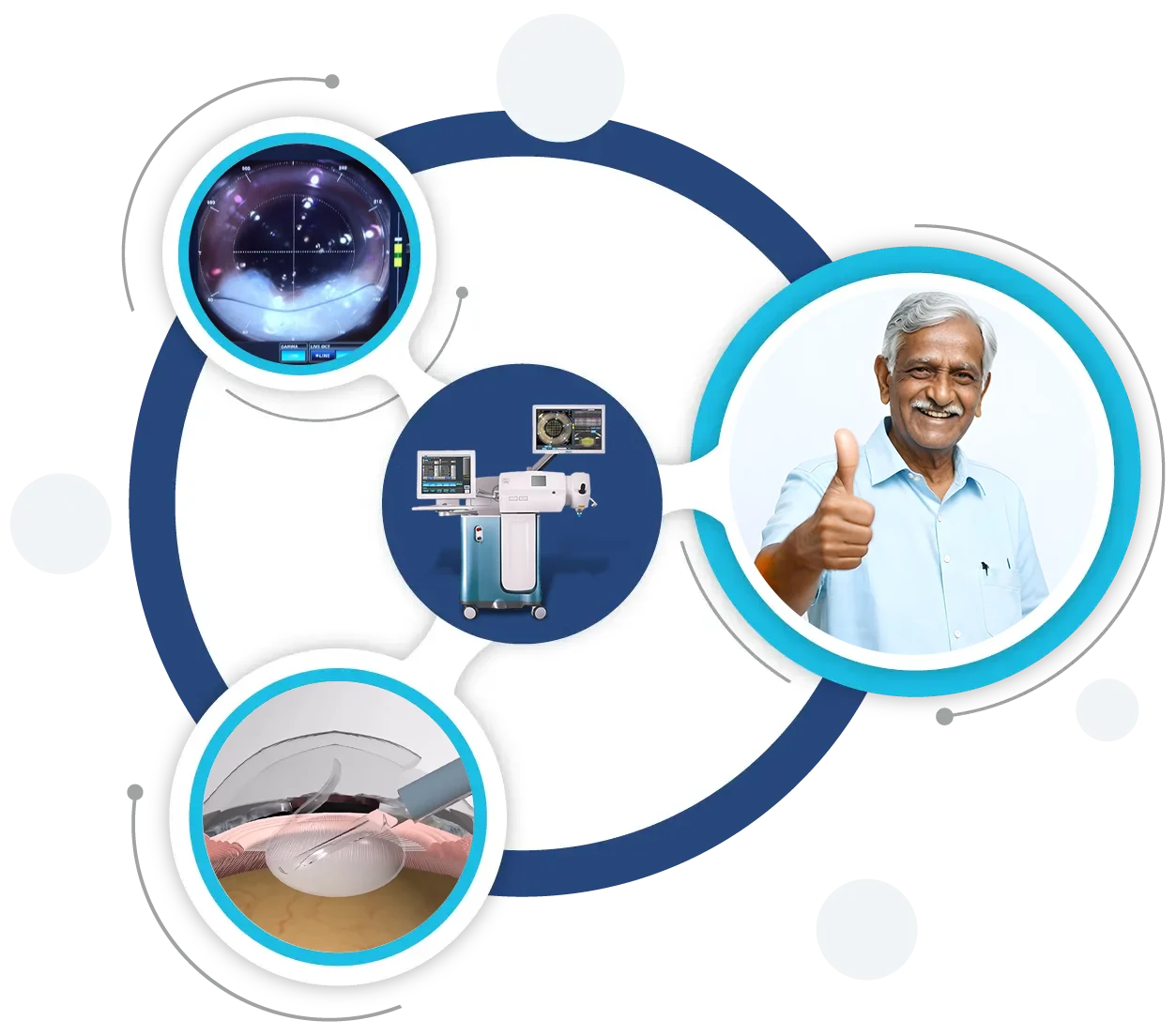 Refractive Eye Surgery