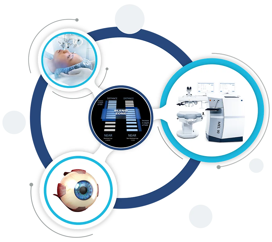 PRESBYOND Laser Eye Surgery